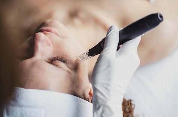 Microneedling Stuttgart